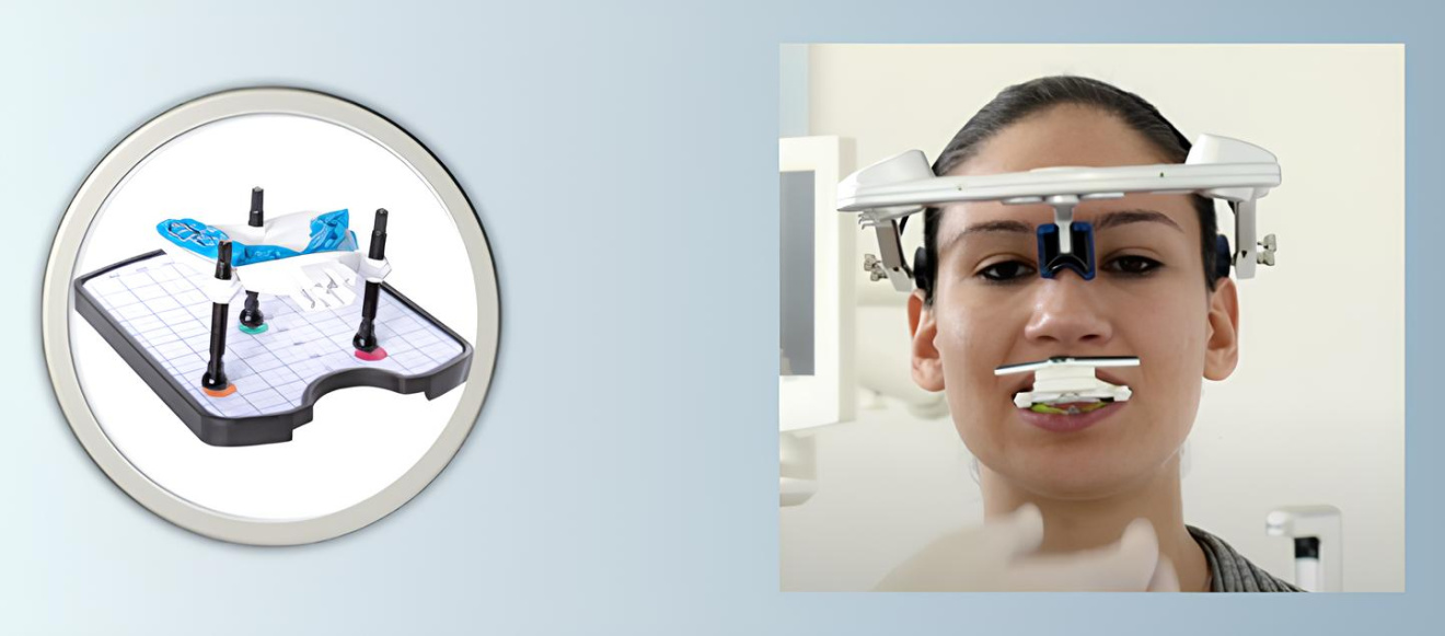 Сопоставление с прикусной вилкой