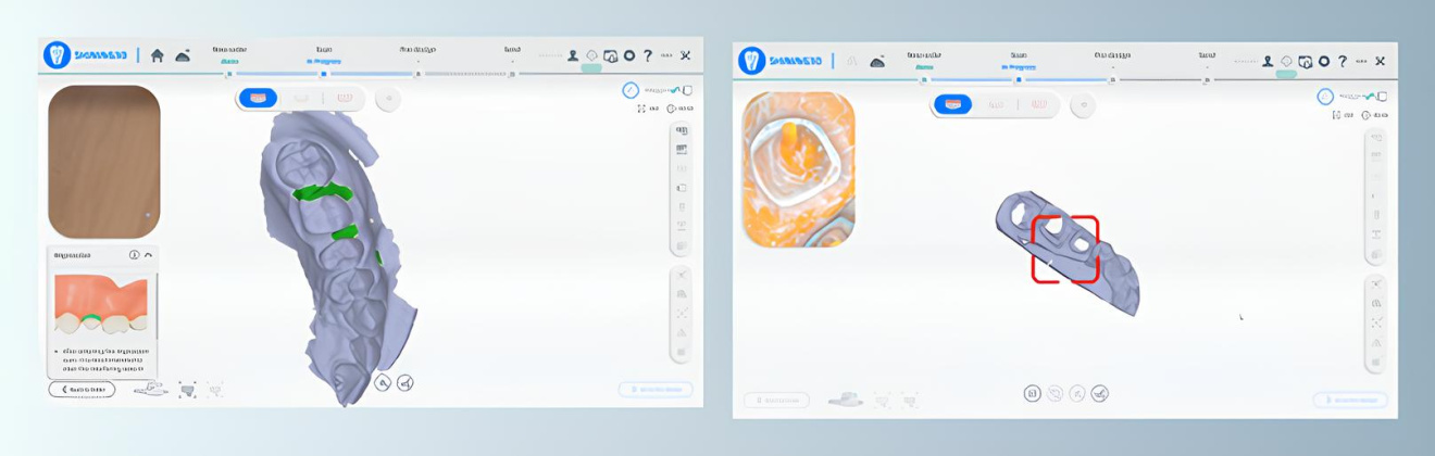 Сканирование оттисков