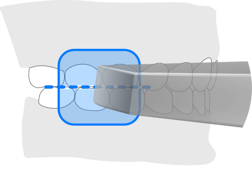 Установка программы сканирования Intraoralscan